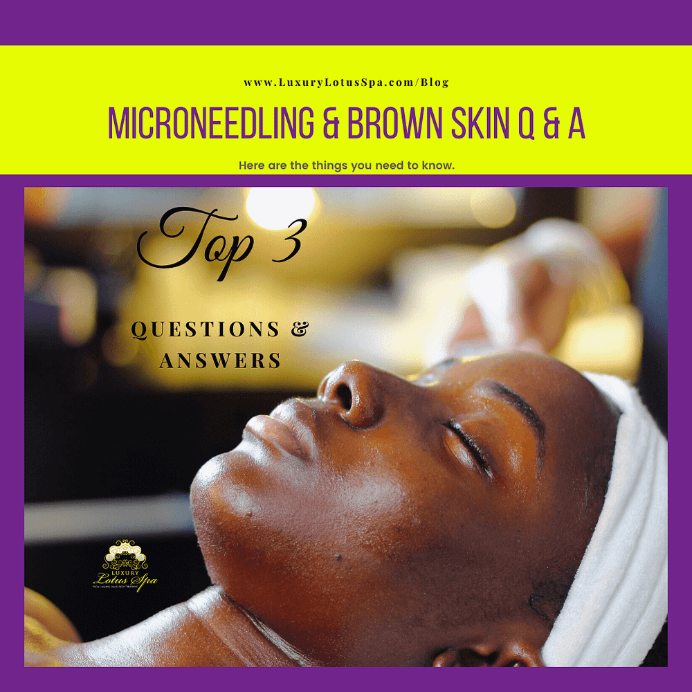 micro needling and dark and brown skin people, black owned spa and salon in tampa florida, best esthetician in the USA, Best esthetician in the world, best esthetician in tampa florida