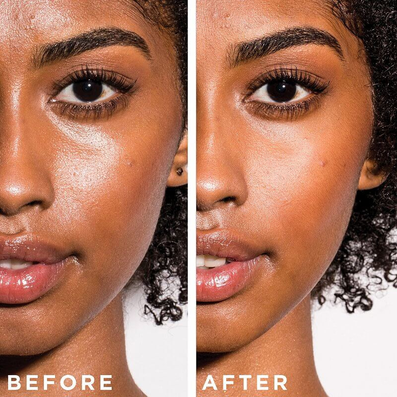 acne scars facial black esthetician chemical peels, microdermabrasion hydrofacial hydrafacial diamond glow tampa florida best black esthetician