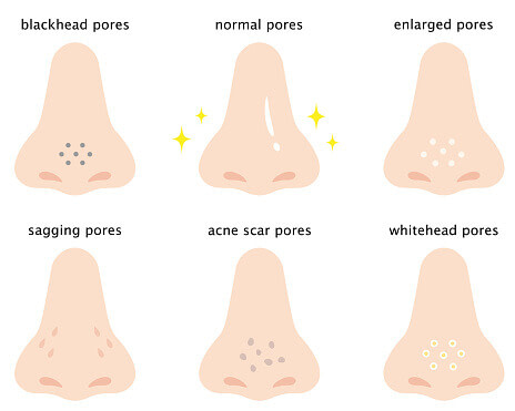 skin pores on human nose illustration. Isolated on white background. clear and even skin products for black women