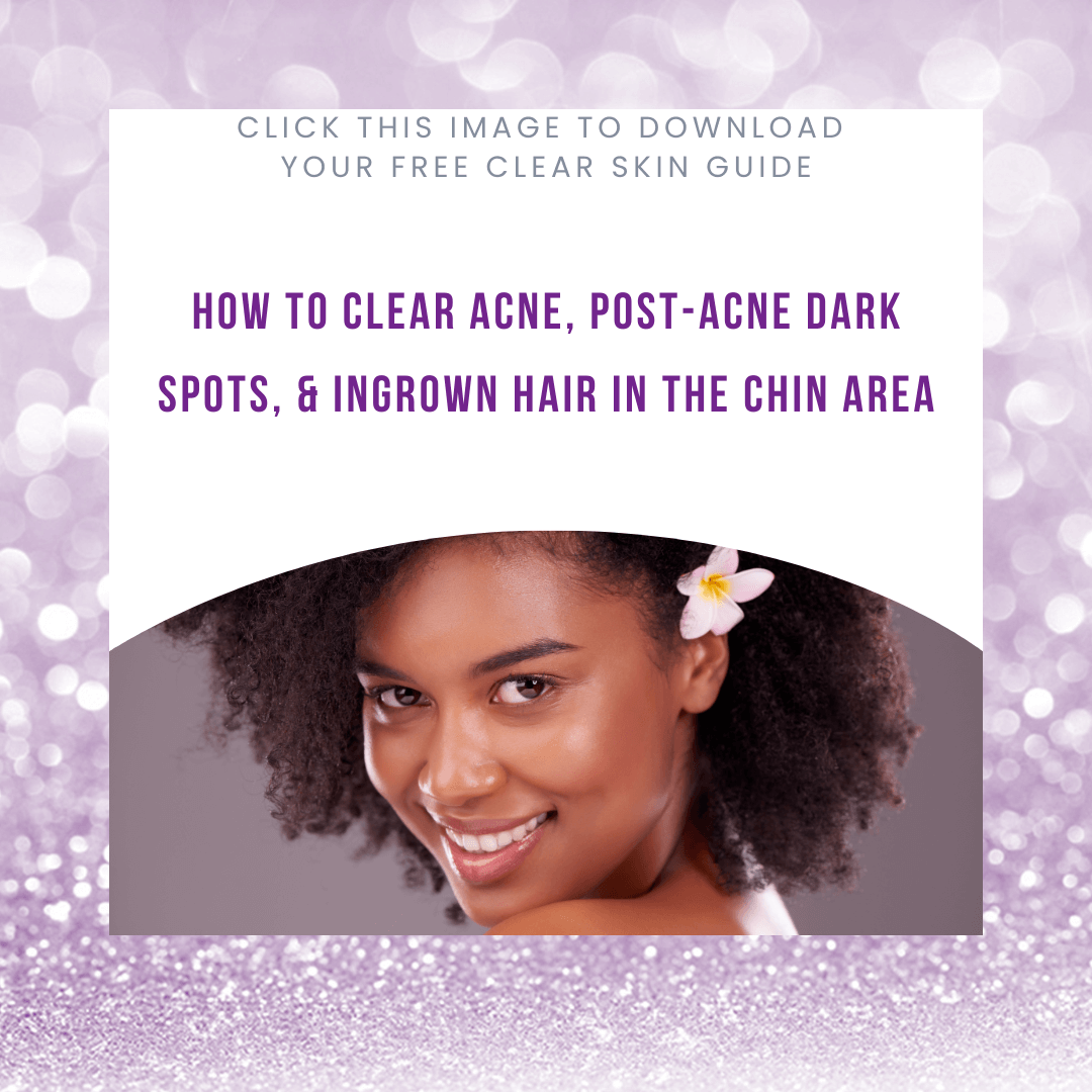 Common skin concerns that also affects men & women of color New Blog Post Instagram Post (4) Common skin concerns that also affects men & women of color