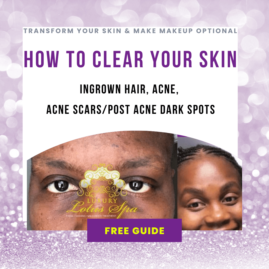 How to get rid of acne scars and post acne dark spots from the comfort of your home - Copy of Sage Elegant New Blog Post Instagram Post (3) If you're worried about the lasting effects of your acne, you'll want to read this. We explore the causes of acne scars and dark spots, and offer treatment options to help reduce or eliminate their appearance of acne, post acne dark spots, and ingrown hair in the chin area. Are my acne scars/post-acne dark spots permanent? , Are my acne scars/post-acne dark spots permanent? | Luxury Lotus Spa, How to remove dark spots caused by acne, Can dark spots from acne be permanent, Do acne scars dark spots go away, How do you know if acne scars are permanent, How long does acne scar discoloration last, Are acne scars permanent?, Hyperpigmentation acne: causes and treatment, Post-inflammatory hyperpigmentation and acne, Can acne scars be removed ( for teens), how to get rid of acne scars, teen vogue, how to care for post-acne marks, how long does it take for acne scars to fade, how long does it take for acne scars to fade, acne scars, causes, acne scar: causes, diagnosis, types & treatment, How to treat acne scarring, how to remove dark spots caused by pimples, acne marks vs acne scars, how to remove acne scars naturally, how long does it take for acne scars to fade, why do my acne scars look worse some days, how to remove dark spots, caused by pimples overnight, how to remove dark spots caused by pimples in 2 days, how to remove acne scars naturally in a week, how to get rid of acne scars + how long does it take to clear acne and post acne dark spots, will acne scars fade over time, safe acne scar treatments for skin of color, acne scars: diagnosis and treatment, Acne scars: who gets and causes, acne scars: how to remove them and regain your clear smooth and even skin complexion, How to get rid of acne scars fast, what works to get rid of acne scars, how to get rid of acne scars and fade pigmentation fast, acne scars what’s the best treatments, mayo clinic, how to get rid of acne scars according to experts vogue, how to get rid of acne scars for good, what is the difference between scar and hyperpigmentation, how to heal acne scars, acne scars treatment in tampa florida, chemical peel treatment near me, acne scar treatment near me, acne treatment near me.black esthetician, tampa florida, esthetician, miami esthetician, atlanta esthetician, orlando esthetician, lakeland esthetician, land o lakes esthetician, wesley chapel esthetician,